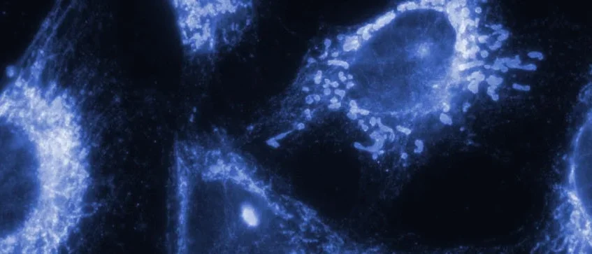 blue stain of cells under a microscope 
