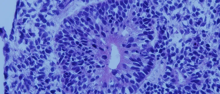 blue stain of cells under a microscope 