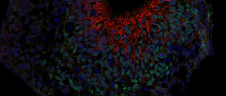 multi-color stain of cells under a microscope