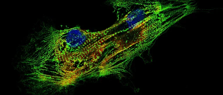 multi-color stain of a cardiomyocyte 