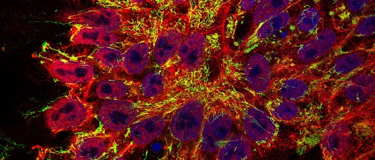 multi-color stain of nuclear GABA in hPSCs 