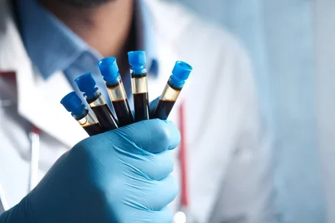 A researcher wearing blue gloves holds a handful of blood draw vials.