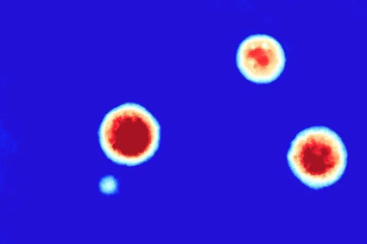The improved process allows researchers to use an advanced imaging method to study and analyze individual organoids in great detail. Credit: Soragni Lab.