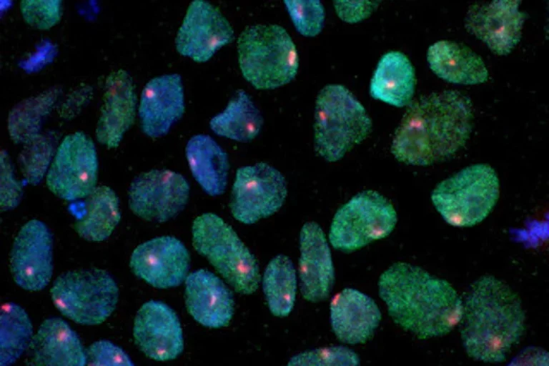 Small Molecule May Inhibit Malignancies in Stem Cell-Derived Therapies