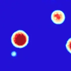 The improved process allows researchers to use an advanced imaging method to study and analyze individual organoids in great detail. Credit: Soragni Lab.